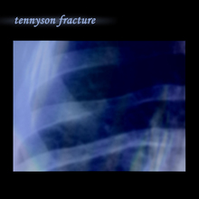 Tennyson Fracture