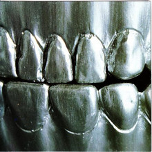 Steel Teeth